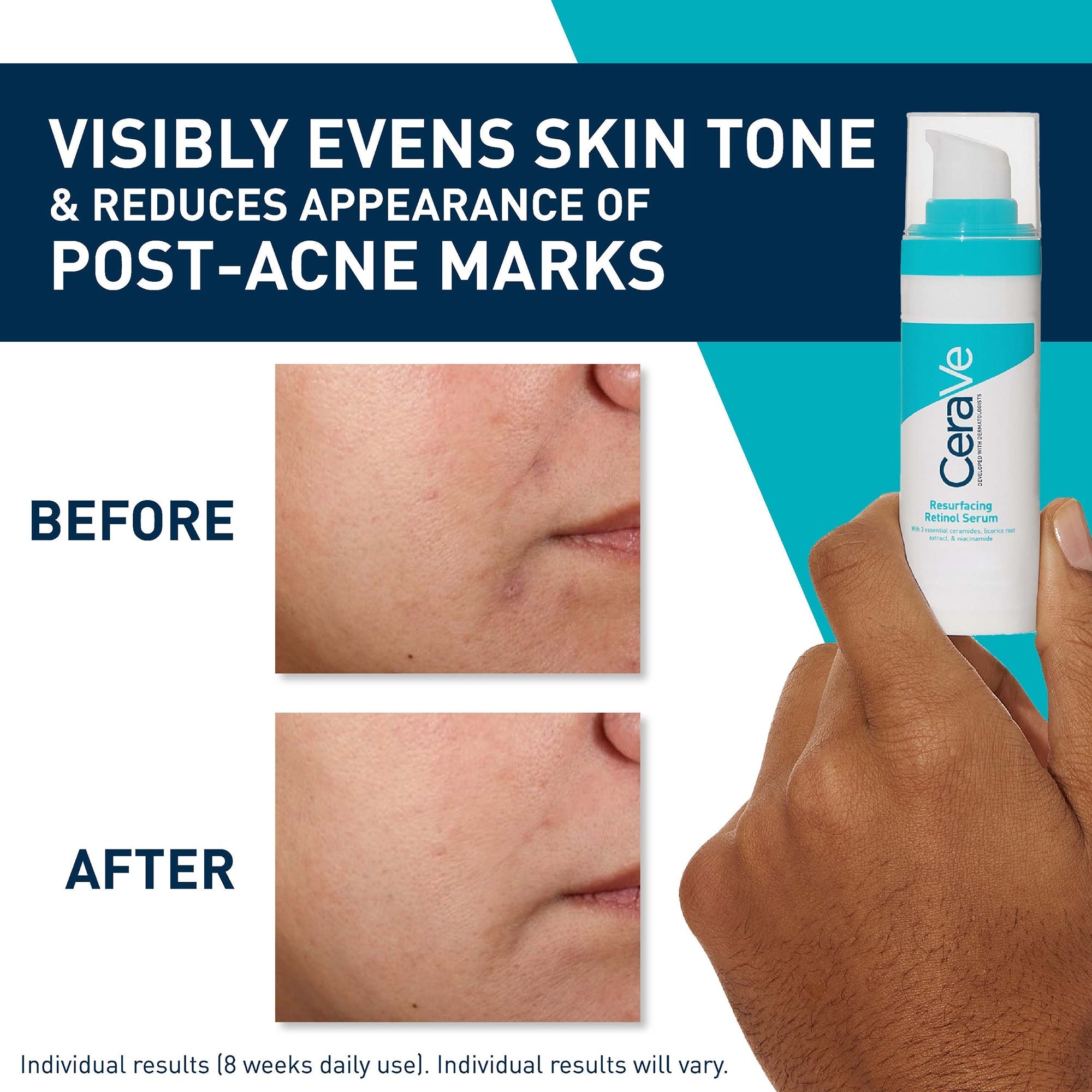 Resurfacing Retinol Serum with Ceramides & Niacinamide 30ml