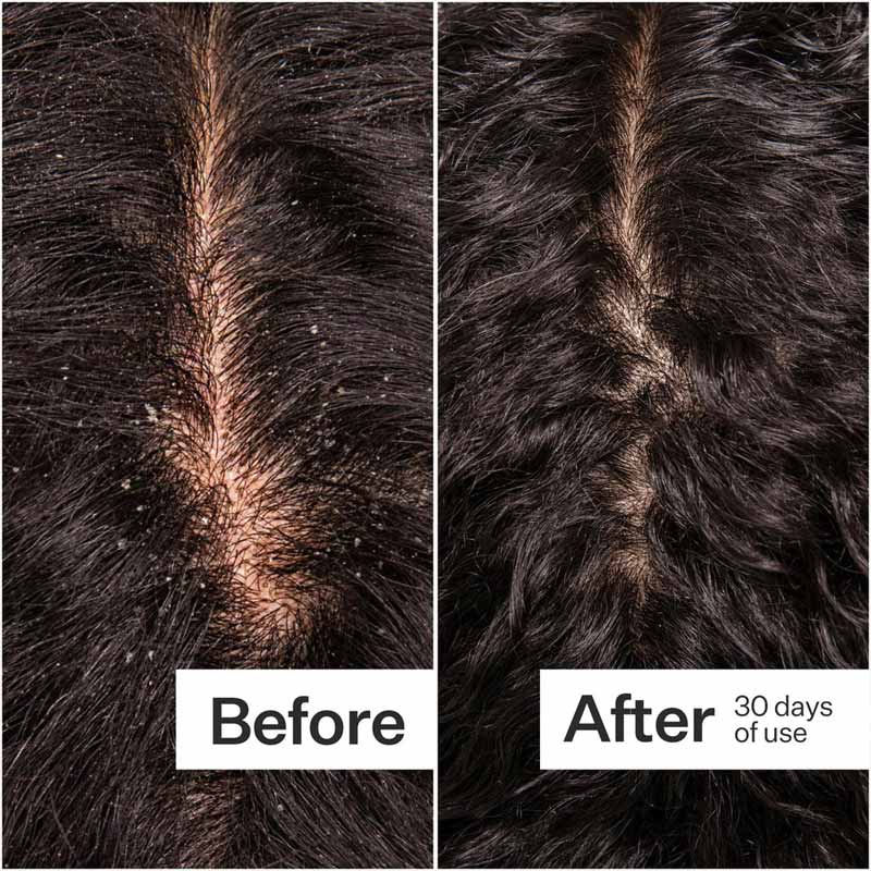 Microbiome Cooling Scalp Serum by Act+Acre