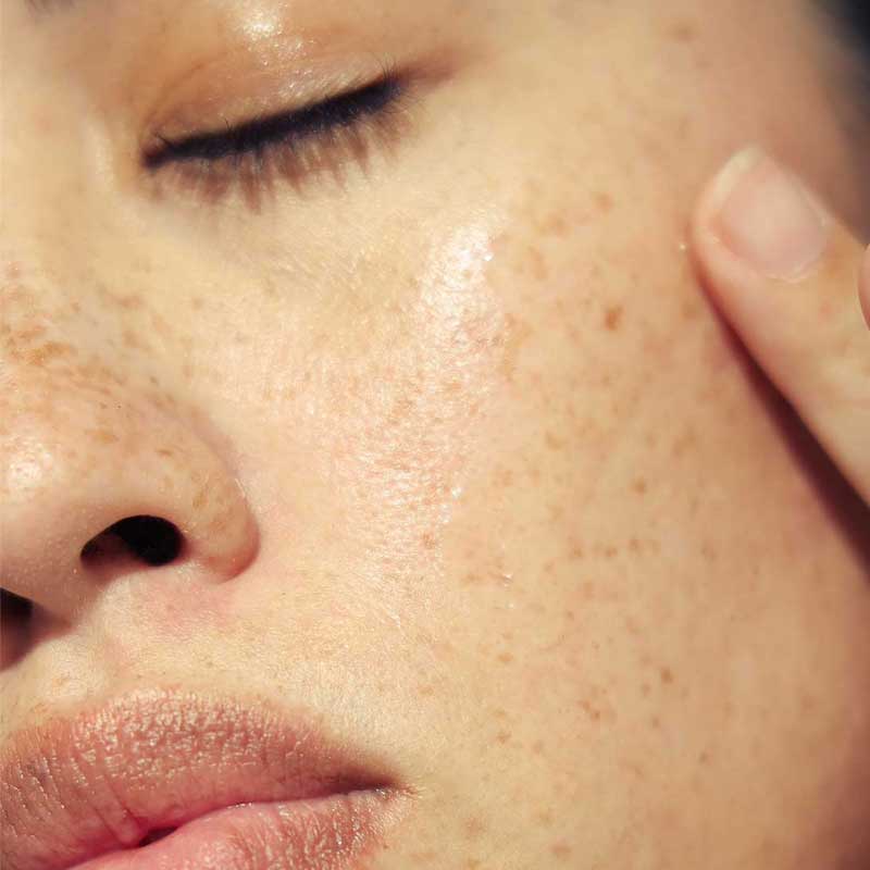 Hyaluronic 8 Super Serum with PrimalHyal Ultrafiller by Alpha-H