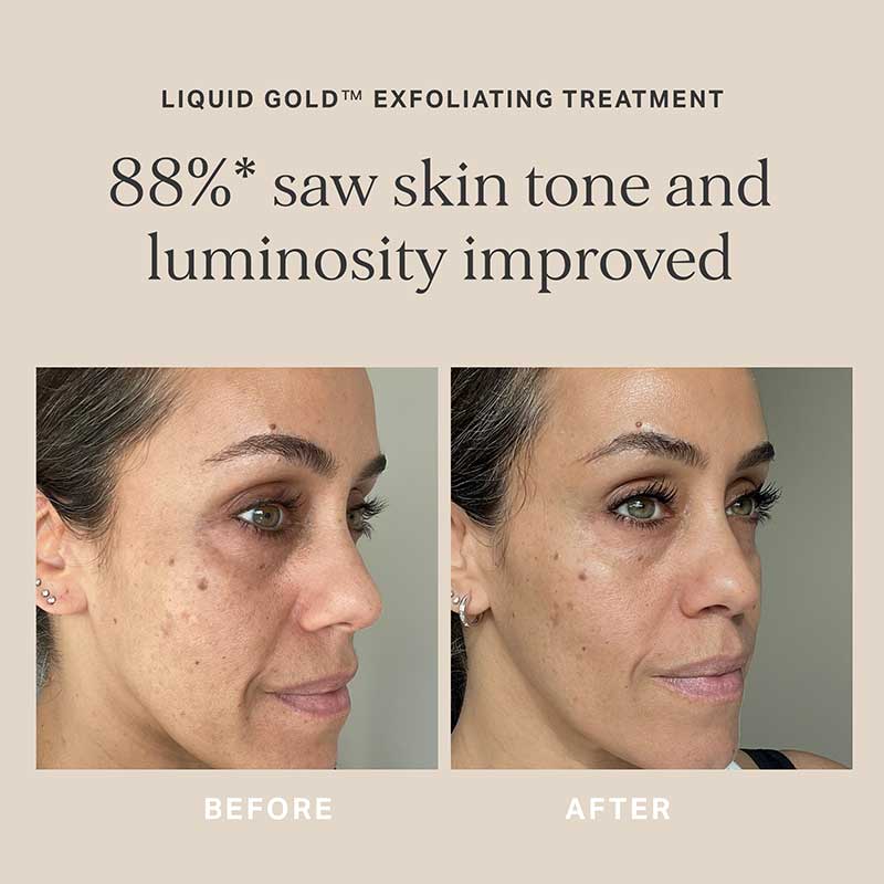 Liquid Gold Exfoliating Treatment With 5% Glycolic Acid by Alpha-H