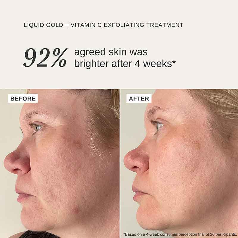 Liquid Gold Exfoliating Treatment 100ml