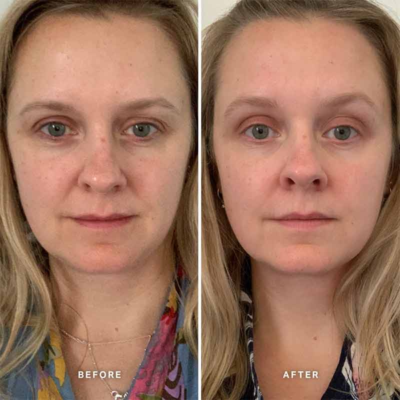 Vitamin A Serum with 0.5% Retinol by Alpha-H