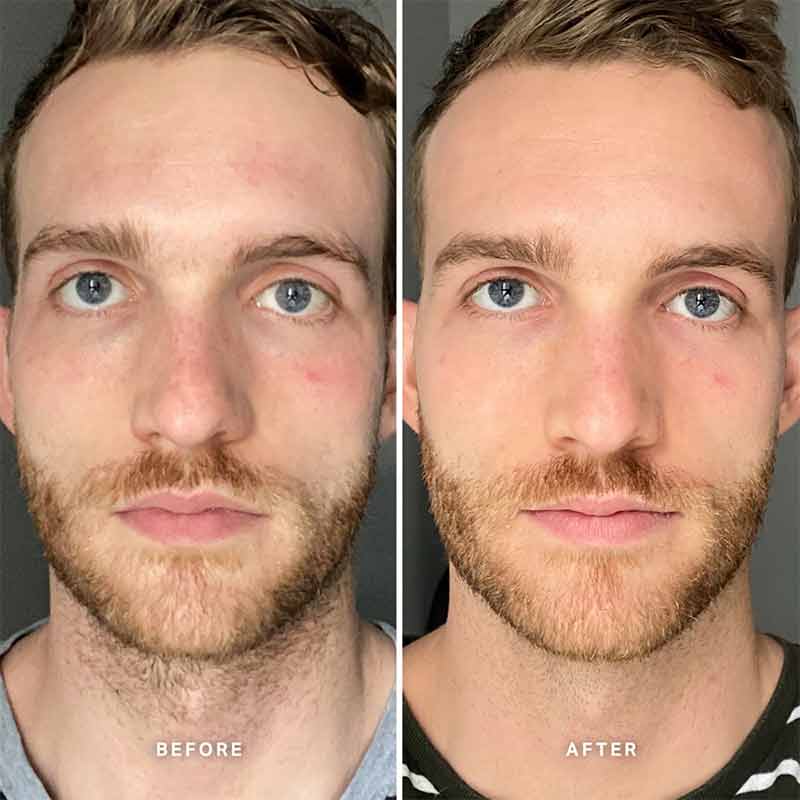 Vitamin B Serum With 5% Niacinamide