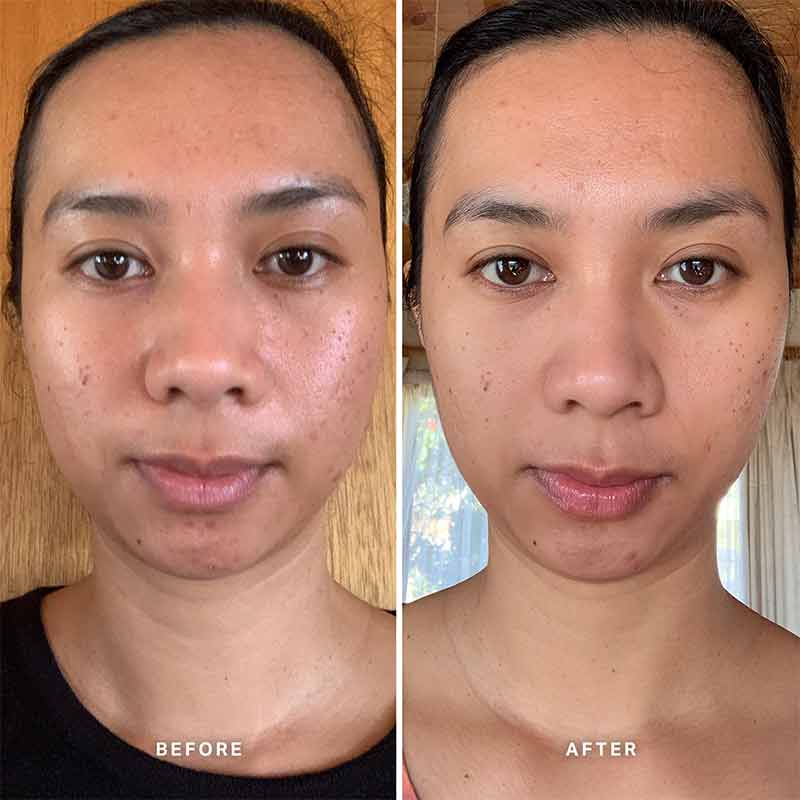 Vitamin C Serum with 10% Ethyl Ascorbic Acid by Alpha-H