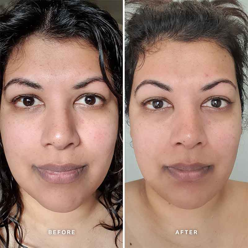 Vitamin C Serum with 10% Ethyl Ascorbic Acid by Alpha-H