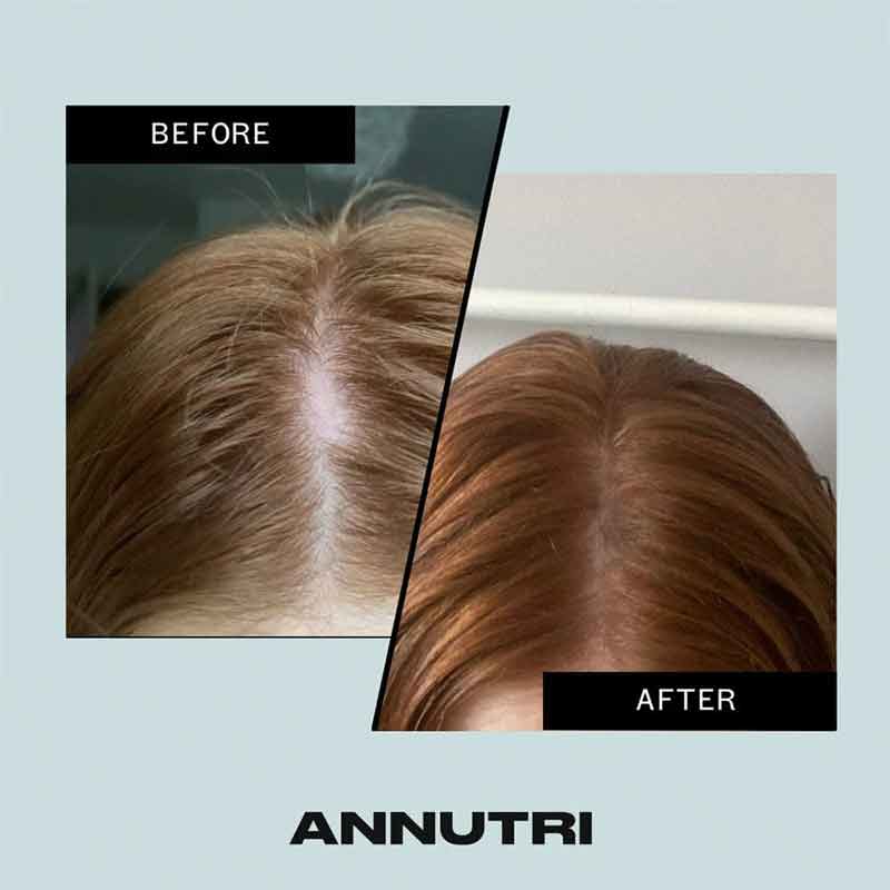 Grow It Hair Growth Supplement 3 Month Supply by Annutri