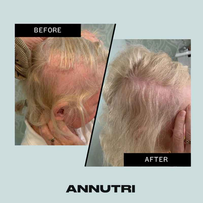 Grow It Hair Growth Supplement by Annutri