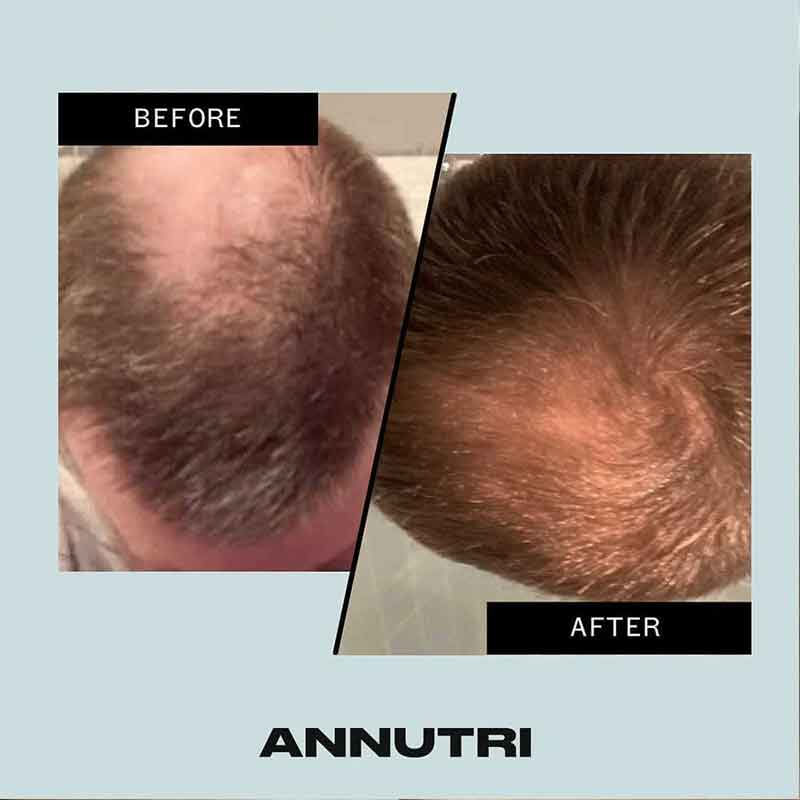 Grow It Hair Growth Supplement by Annutri