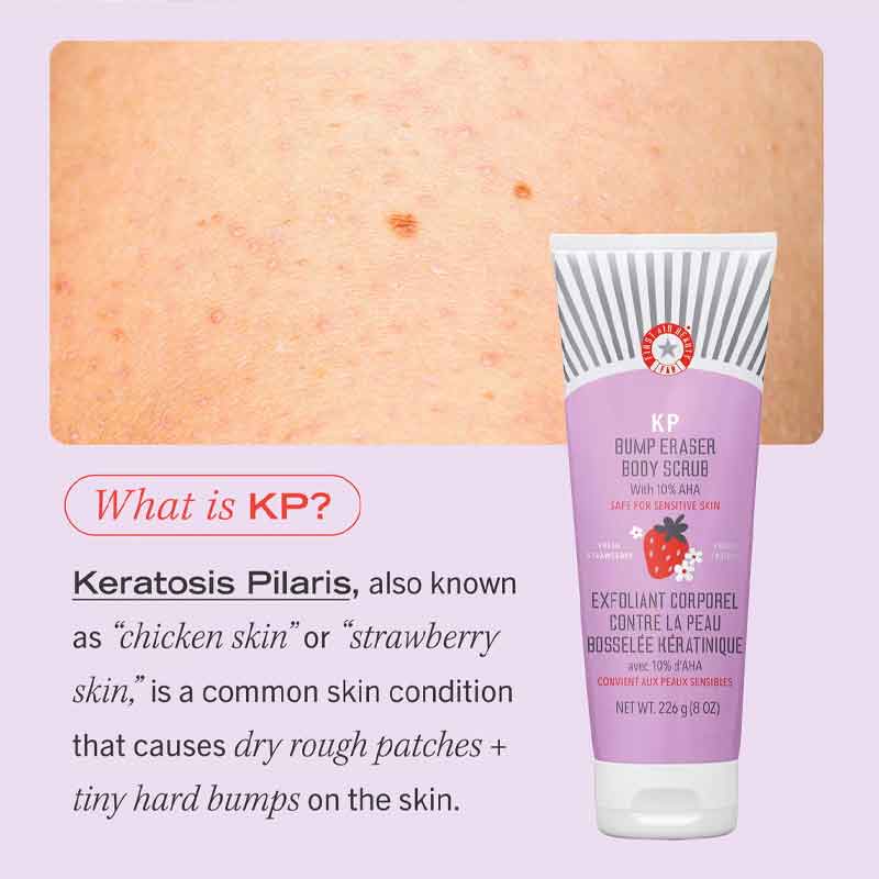 KP Bump Eraser Body Scrub Fresh Strawberry by First Aid Beauty