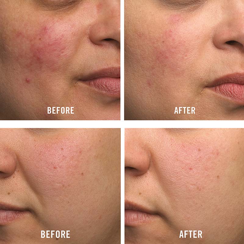Ultra Repair Cream Travel Size 56g