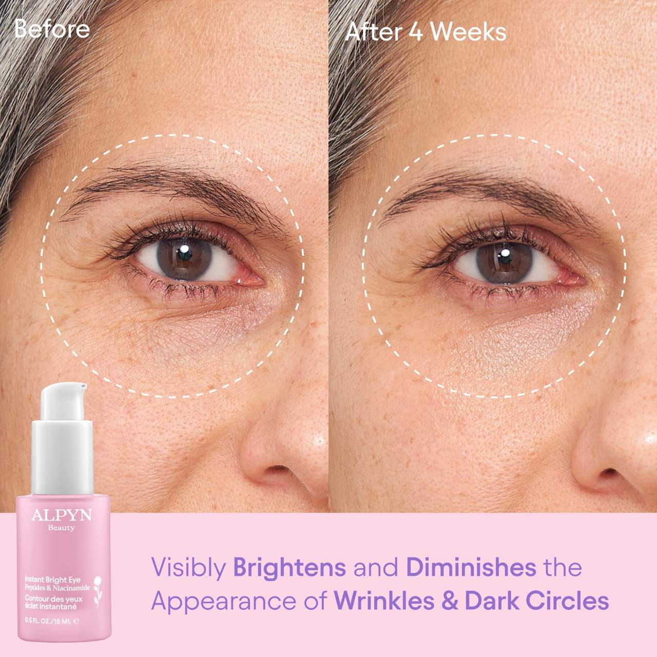 ALPYN Instant Bright Eye Dark Circle Firming Cream with Niacinamide & Peptides