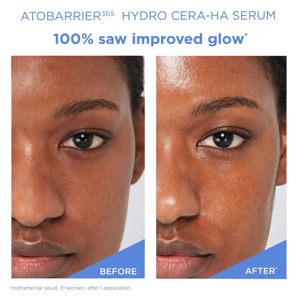 AESTURA ATOBARRIER365 Hydro CERA-HA Ceramide + Hyaluronic Acid Face Serum for Skin Moisture Barrier Repair
