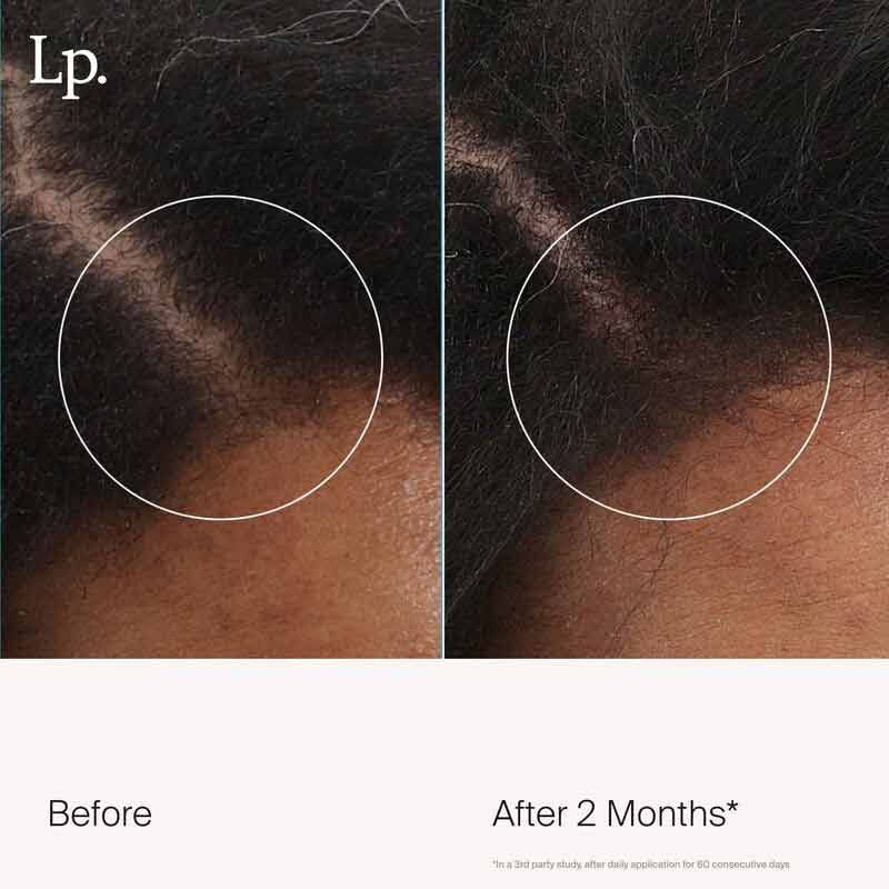 Scalp Care Revitalizing Treatment by Living Proof