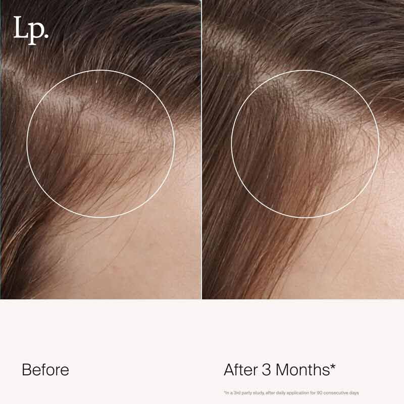 Scalp Care Revitalizing Treatment by Living Proof
