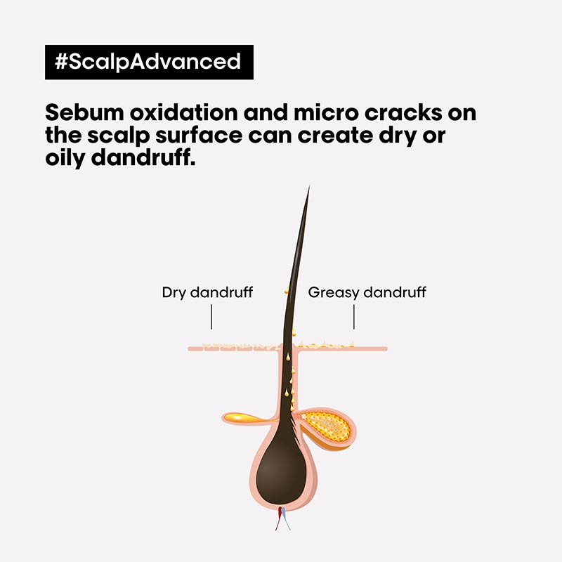 Scalp Advanced Anti-Dandruff Dermo-Clarifier Shampoo by L'Oreal Professionnel