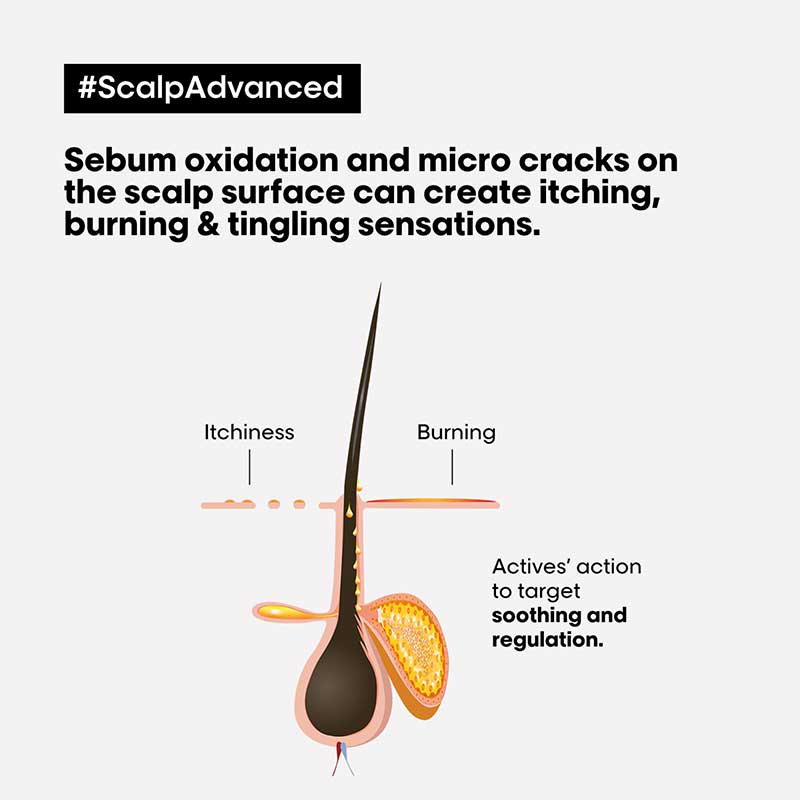 Serie Expert Scalp Advanced Anti-Discomfort Dermo-Regulator Shampoo by L'Oréal Professionnel