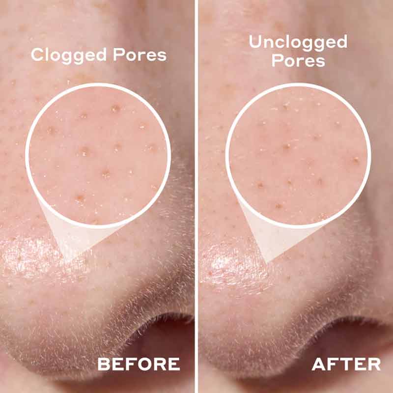 2-in-1 Deep Cleansing Pore Strip by Mario Badescu