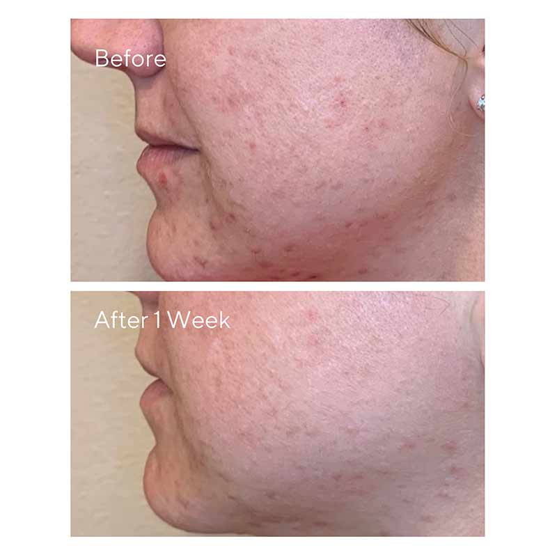 Daily Clarifying Peel