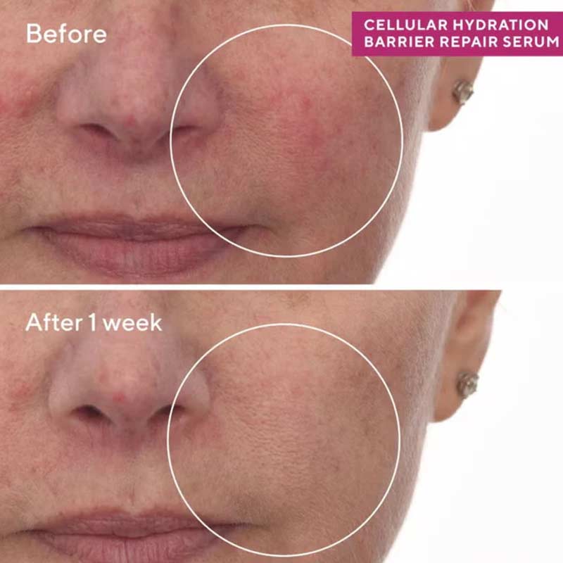 Cellular Hydration Barrier Repair Serum by Murad