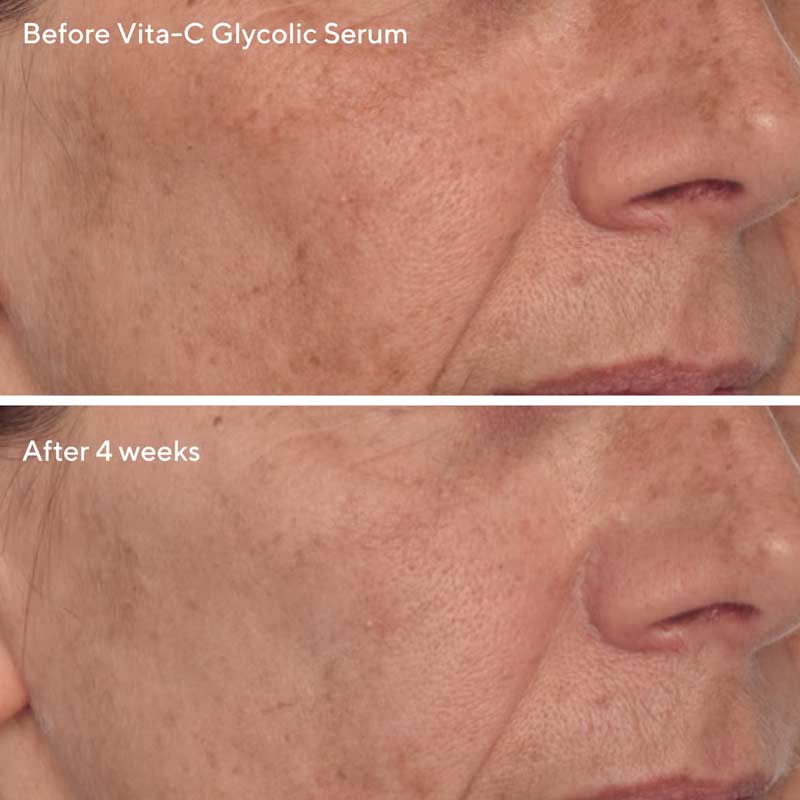 Radiant Skin Discovery Kit