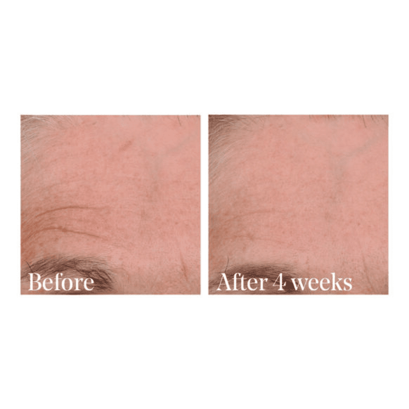 Retinal ReSculpt Overnight Treatment by Murad