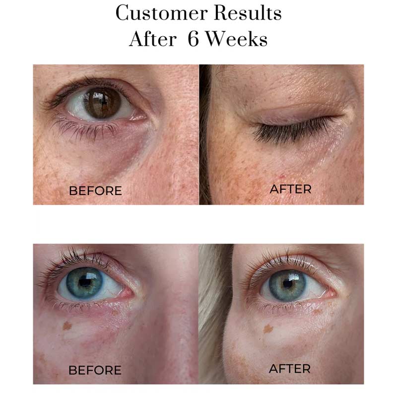 Eye Wonder Nutri-Active Eye Serum