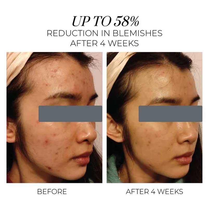 Violet Water Hydra-Gel Clarifying Daily Moisturiser by OSKIA