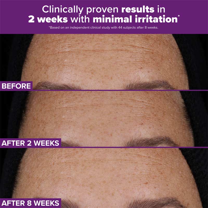 Clinical Pro Retinaldehyde Dual-Retinoid Treatment 30ml