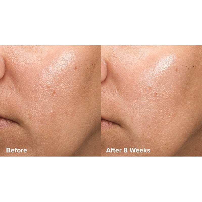 Skin Perfecting 6% Mandelic Acid + 2% Lactic Acid Liquid Exfoliant