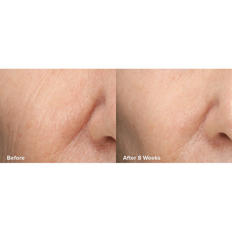 Skin Perfecting 6% Mandelic Acid + 2% Lactic Acid Liquid Exfoliant Travel Size by Paula's Choice
