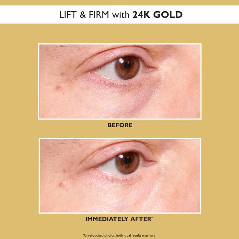 24K Gold Pure Luxury Lift & Firm Hydra-Gel Eye Patches by Peter Thomas Roth