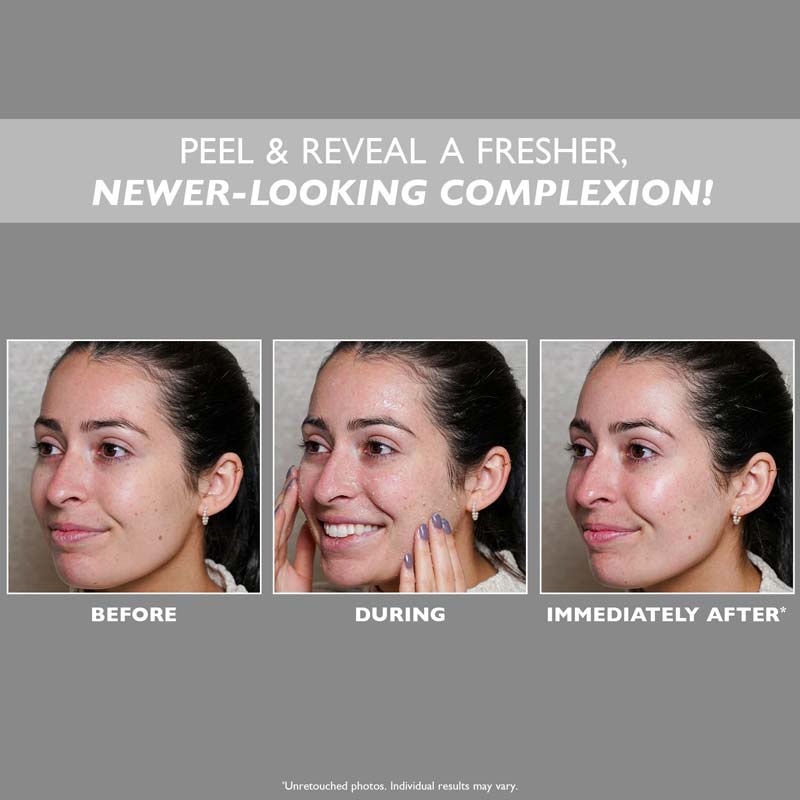 FIRMx Peeling Gel