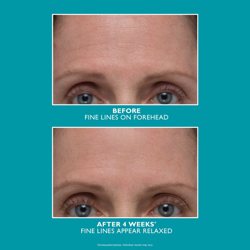 Peptide Skinjection Amplified Wrinkle-Fix Serum by Peter Thomas Roth