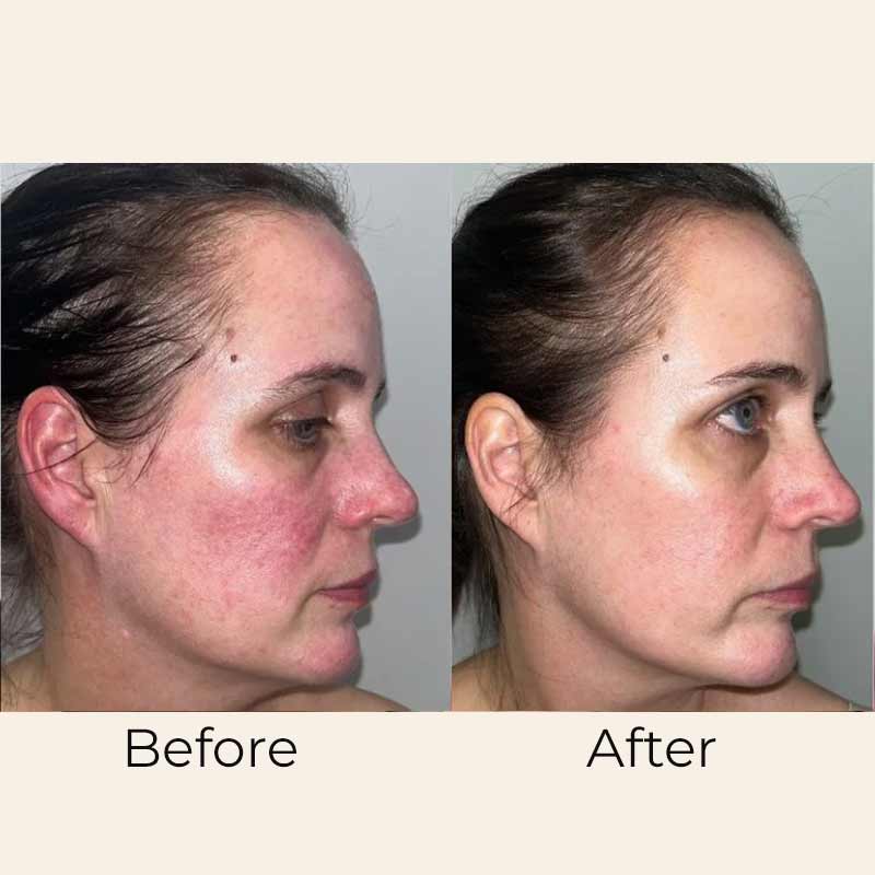 Hydra Hyaluronic Acid Serum by Skin Formulas