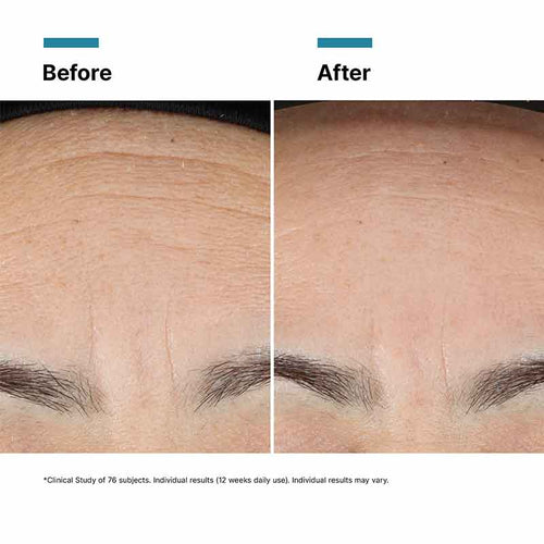 Advanced RGN-6 Aesthetic Recovery Cream by SkinCeuticals