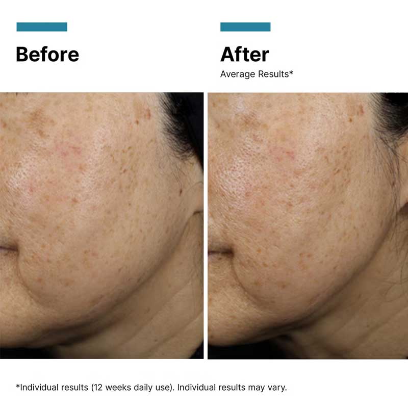 A.G.E. Interrupter Ultra Serum + Free 15ml Serum