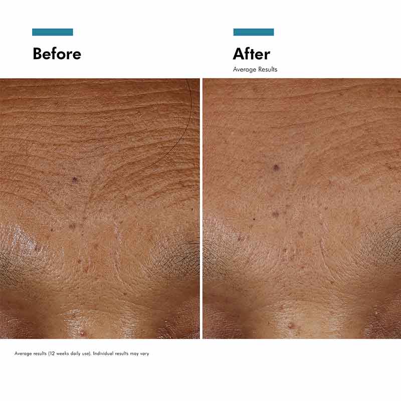HA Intensifier Multi-Glycan Serum + Free 15ml Gift