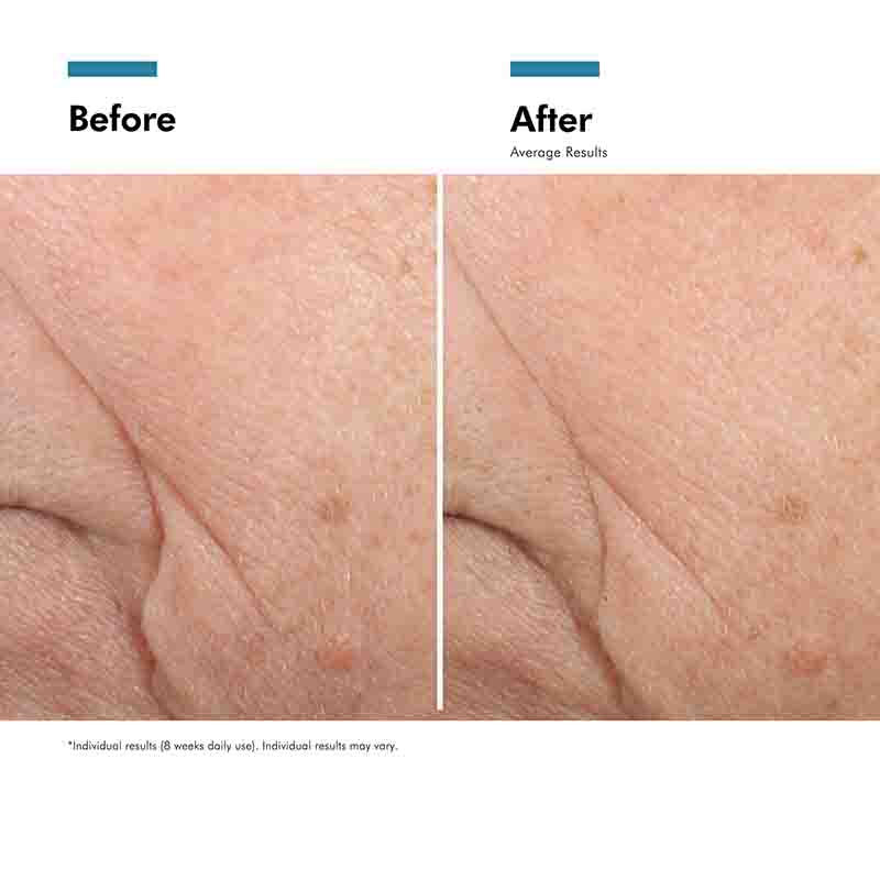 Triple Lipid Restore 2:4:2 Moisturiser by SkinCeuticals