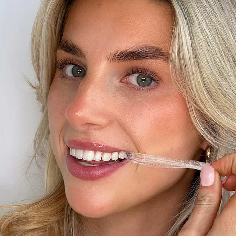 Ultra Teeth Whitening Strips 7 Day by Spotlight Oral Care