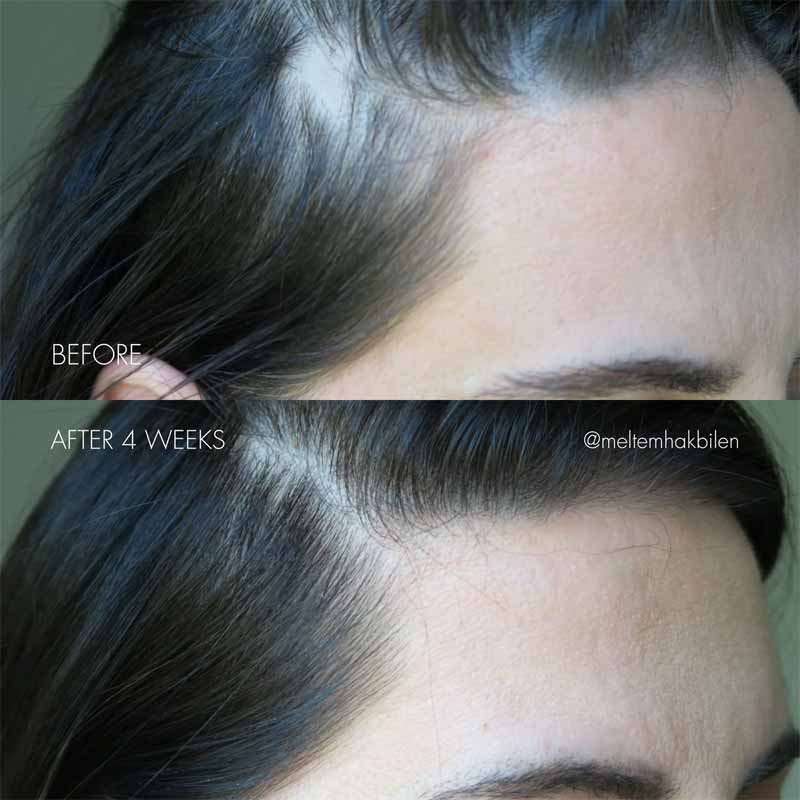 The Hair Serum by SWEED
