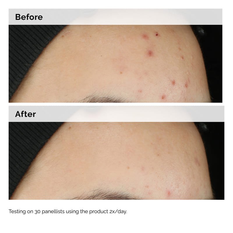 Balancing & Clarifying Serum by The Ordinary