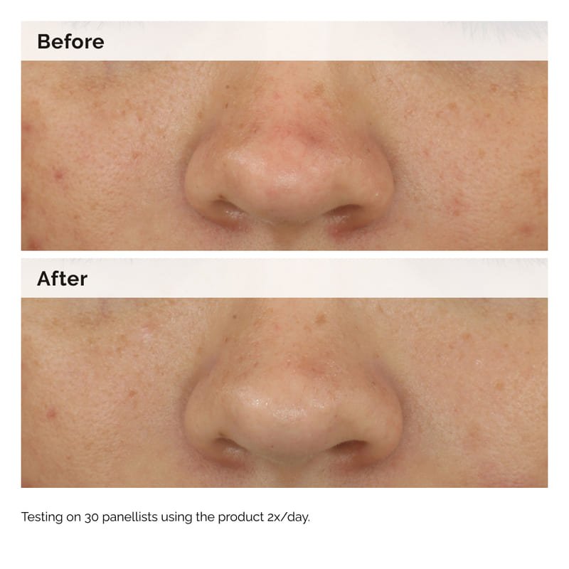 Balancing & Clarifying Serum by The Ordinary