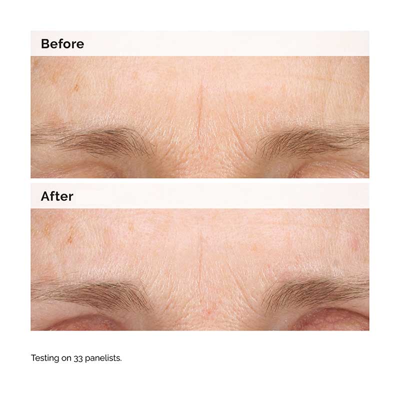 Retinal 0.2% Emulsion by The Ordinary