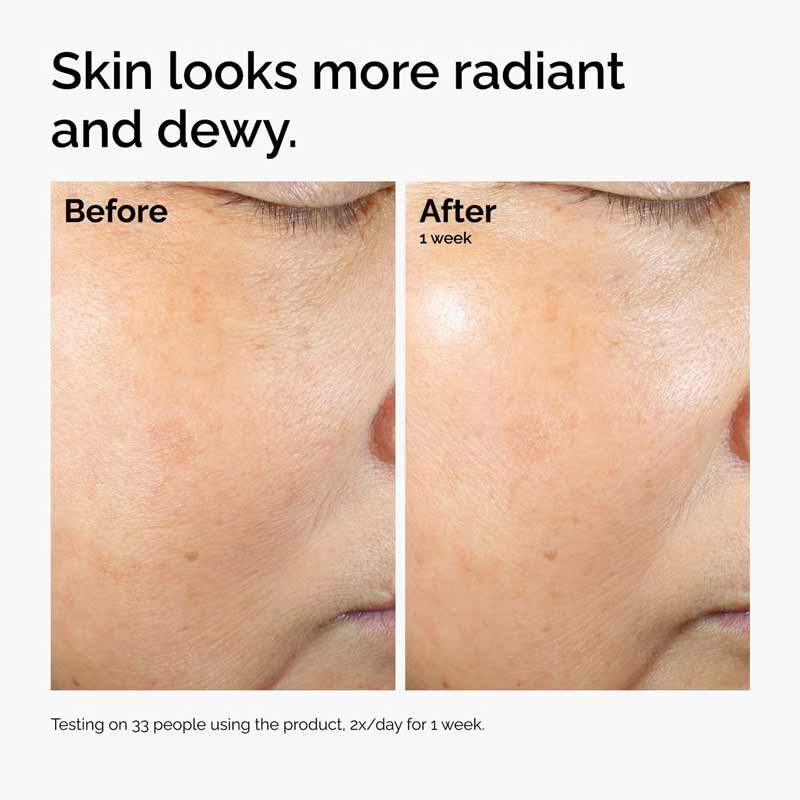 Rice Lipids + Ectoin Microemulsion Ultra-Lightweight Moisturiser 100ml