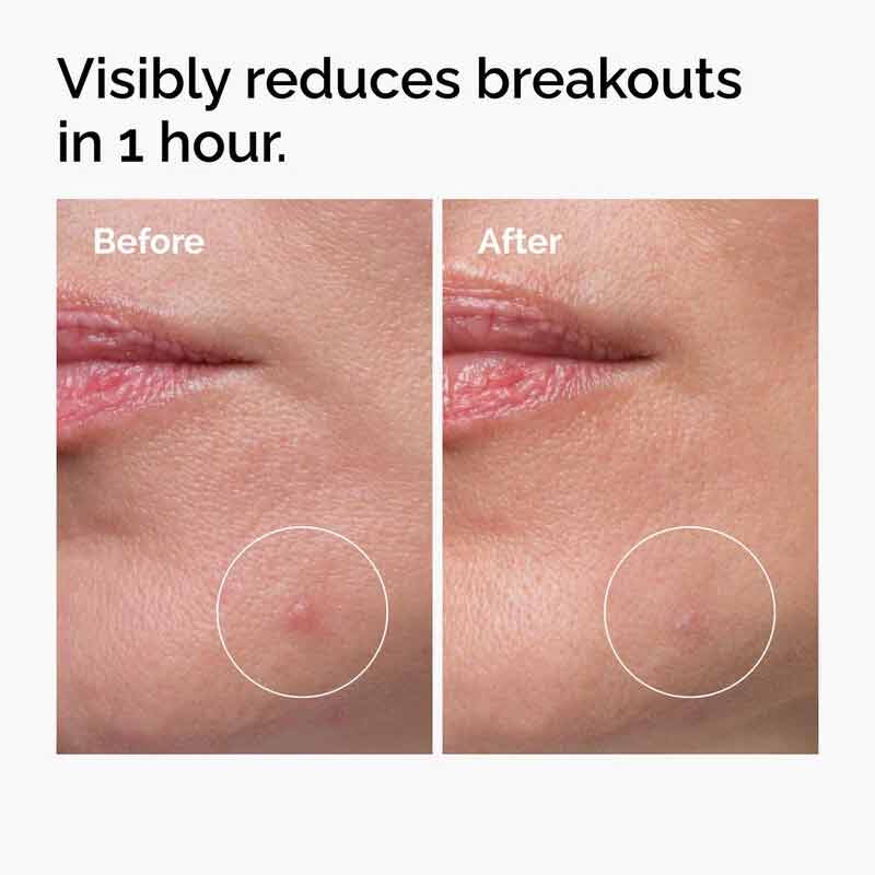 Sulfur 10% Powder to Cream Concentrate by The Ordinary
